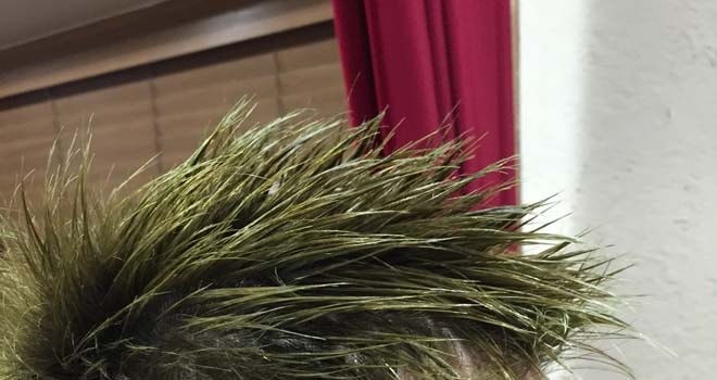 髪が毬藻になりました。でも安心してください…