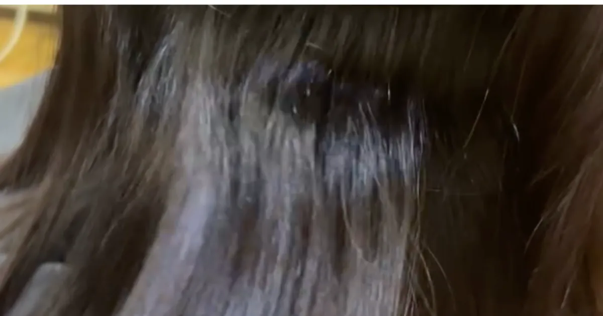 大宮から縮毛矯正でご来店されるお客様のビフォアー写真